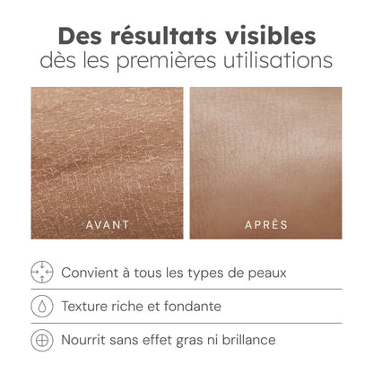 Crème Hydratante Anti-tâches au curcuma