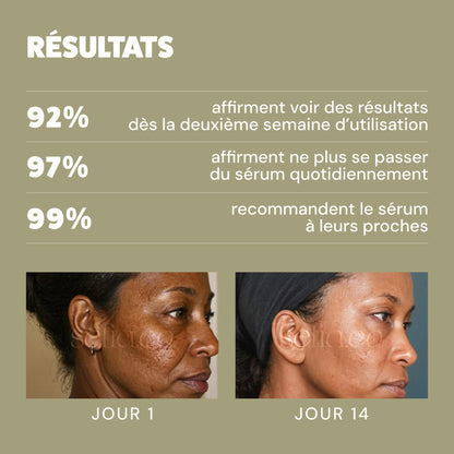 Sérum Anti-Taches au curcuma