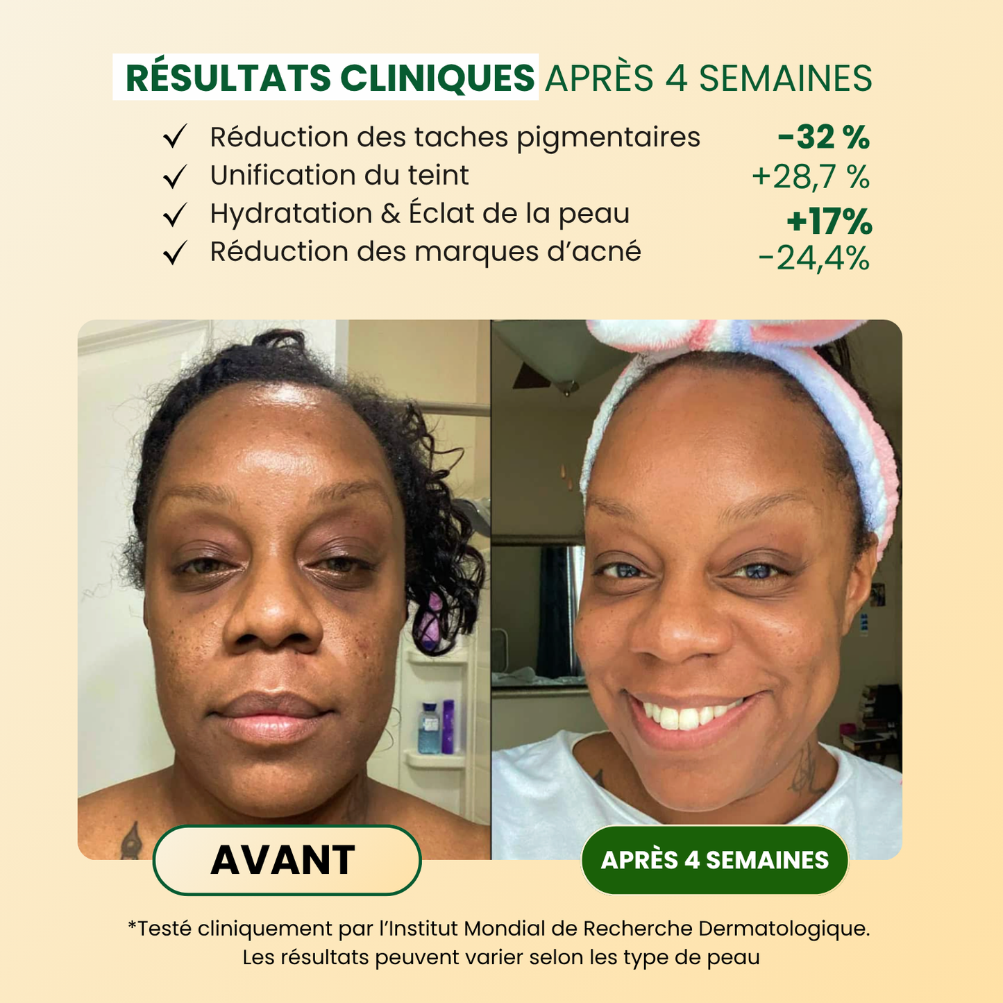 Savon Anti-Taches &amp; Hyperpigmentation Au Curcuma (+200g OFFRES)