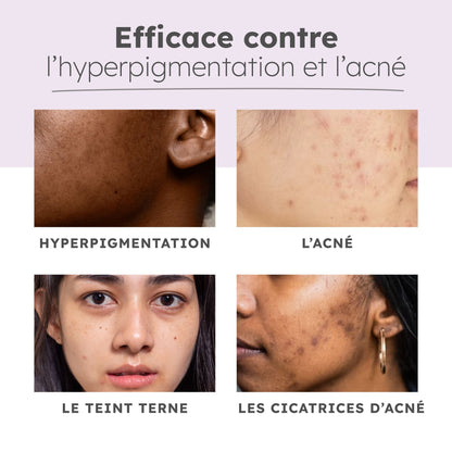 Nettoyant Éclat au Curcuma