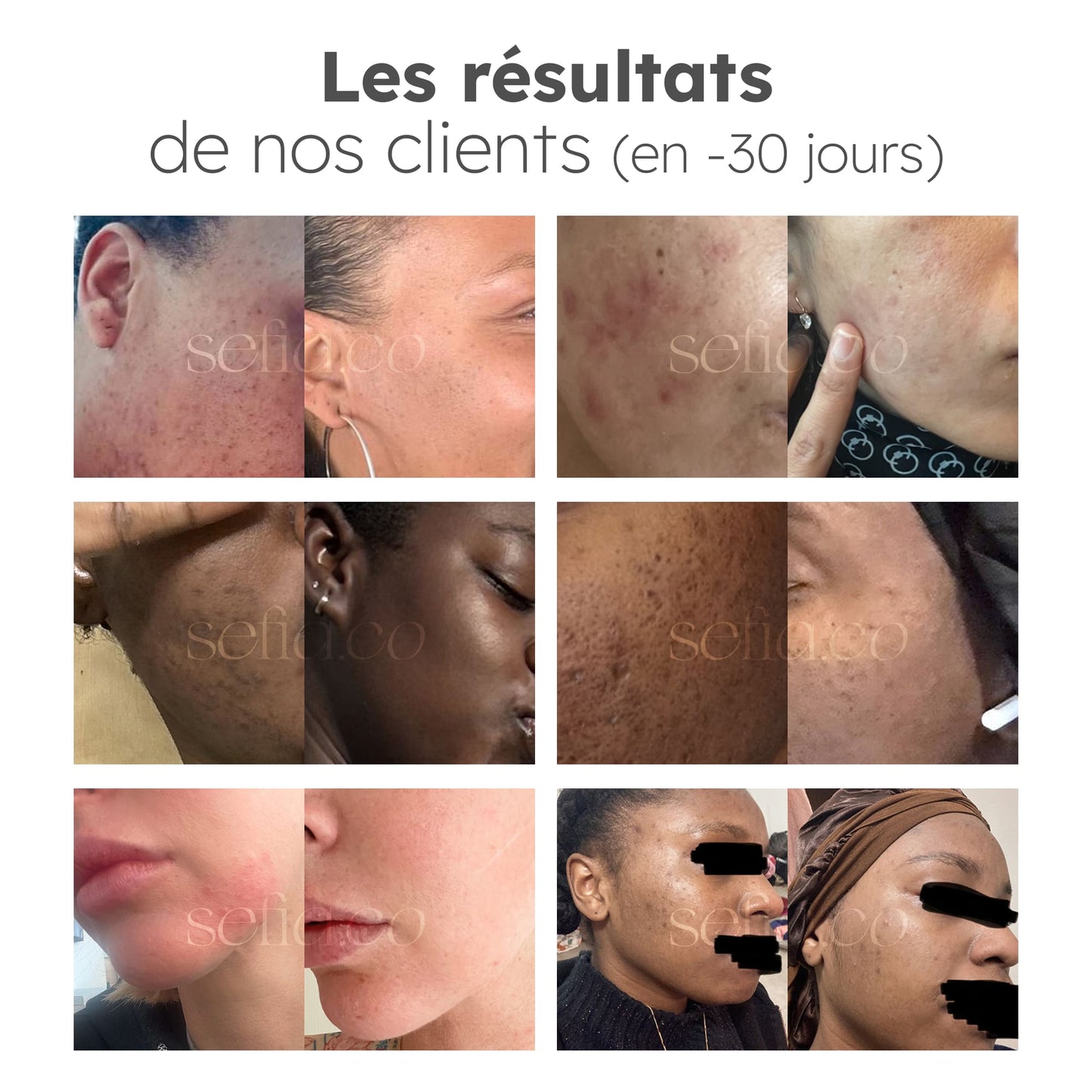 Nettoyant Éclat au Curcuma