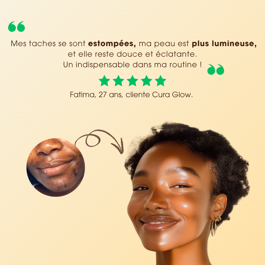 Savon Anti-Taches &amp; Hyperpigmentation Au Curcuma (+200g OFFRES)